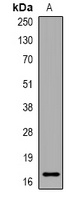 PLGRKT Rabbit Polyclonal Antibody