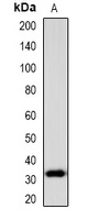 PENK Rabbit Polyclonal Antibody