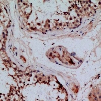 PENK Rabbit Polyclonal Antibody