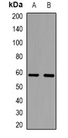 TRP2 Rabbit Polyclonal Antibody