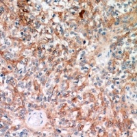 TRP2 Rabbit Polyclonal Antibody