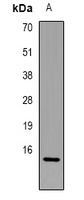 FABP7 Rabbit Polyclonal Antibody