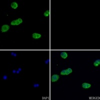 Beta-actin Rabbit Polyclonal Antibody
