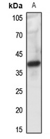 FPR1 Rabbit Polyclonal Antibody