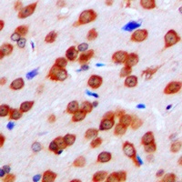 FPR1 Rabbit Polyclonal Antibody