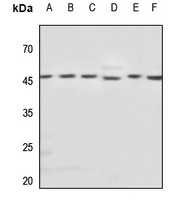 Beta-tubulin Rabbit Polyclonal Antibody