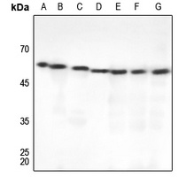 Beta-tubulin Rabbit Polyclonal Antibody