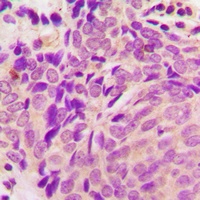 Beta-tubulin Rabbit Polyclonal Antibody