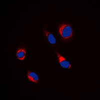 Beta-tubulin Rabbit Polyclonal Antibody
