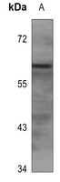 EPN2 Rabbit Polyclonal Antibody