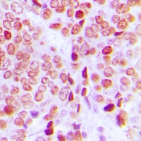 PE2 (Phospho-T526) Rabbit Polyclonal Antibody