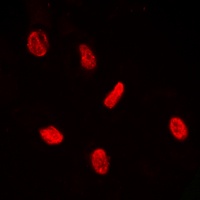 PE2 (Phospho-T526) Rabbit Polyclonal Antibody
