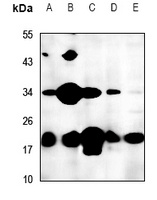 FTH1 Rabbit Polyclonal Antibody