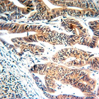 GBP1 Rabbit Polyclonal Antibody