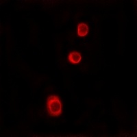 GBP1 Rabbit Polyclonal Antibody
