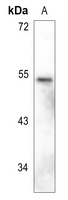 GFAP Rabbit Polyclonal Antibody