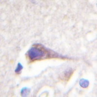 GFAP Rabbit Polyclonal Antibody
