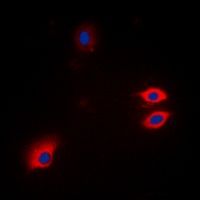 GFAP Rabbit Polyclonal Antibody