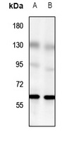 GPR56 Rabbit Polyclonal Antibody