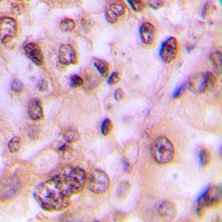 GSK3 beta (Phospho-S9) Rabbit Polyclonal Antibody