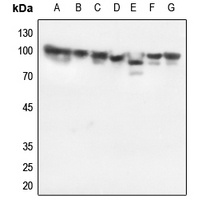 HSP90 beta Rabbit Polyclonal Antibody