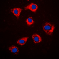 HSP90 beta Rabbit Polyclonal Antibody