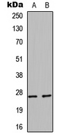 HSP27 Rabbit Polyclonal Antibody