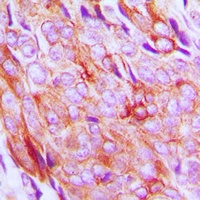 IGF1 Receptor (Phospho-Y1161) Rabbit Polyclonal Antibody