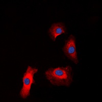 IGF1 Receptor (Phospho-Y1161) Rabbit Polyclonal Antibody