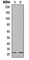 Ig lambda C Rabbit Polyclonal Antibody