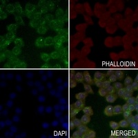 CD213a2 Rabbit Polyclonal Antibody