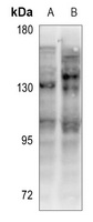 CD130 Rabbit Polyclonal Antibody