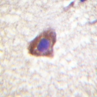 CD130 Rabbit Polyclonal Antibody