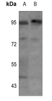 Insulin Receptor (Phospho-Y1355) Rabbit Polyclonal Antibody