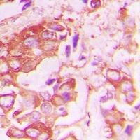 Insulin Receptor (Phospho-Y1355) Rabbit Polyclonal Antibody