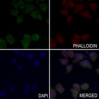 Insulin Receptor (Phospho-Y1355) Rabbit Polyclonal Antibody