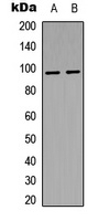 Insulin Receptor (Phospho-Y1361) Rabbit Polyclonal Antibody