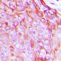 Insulin Receptor (Phospho-Y1361) Rabbit Polyclonal Antibody