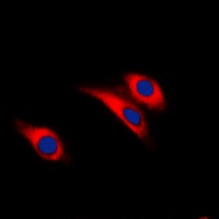 Insulin Receptor (Phospho-Y1361) Rabbit Polyclonal Antibody