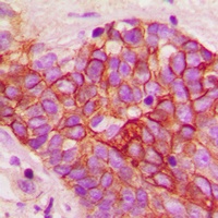 CD29 (Phospho-T789) Rabbit Polyclonal Antibody