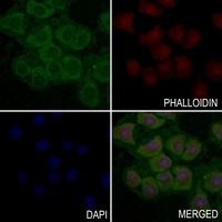 CD61 (Phospho-Y785) Rabbit Polyclonal Antibody