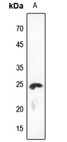 KDELR2 Rabbit Polyclonal Antibody