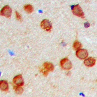 KDELR2 Rabbit Polyclonal Antibody
