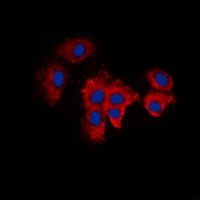 KDELR2 Rabbit Polyclonal Antibody