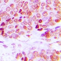 Lamin A/C Rabbit Polyclonal Antibody