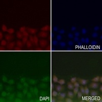 Lamin A/C Rabbit Polyclonal Antibody
