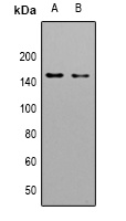 LMTK3 Rabbit Polyclonal Antibody