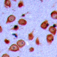 LMTK3 Rabbit Polyclonal Antibody