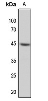 MKK1 Rabbit Polyclonal Antibody