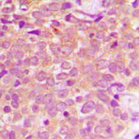 MKK1 Rabbit Polyclonal Antibody